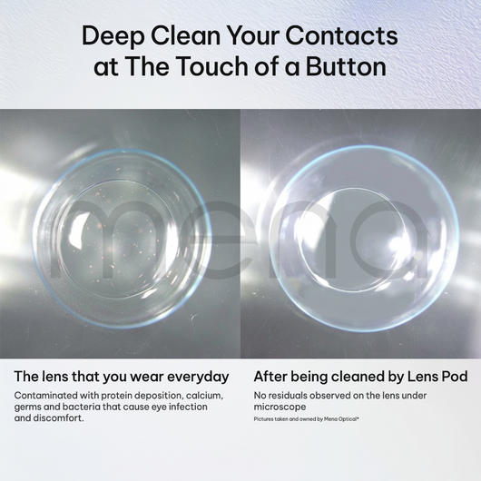 Careandco™ Ultra-Sonic Lens Cleaner